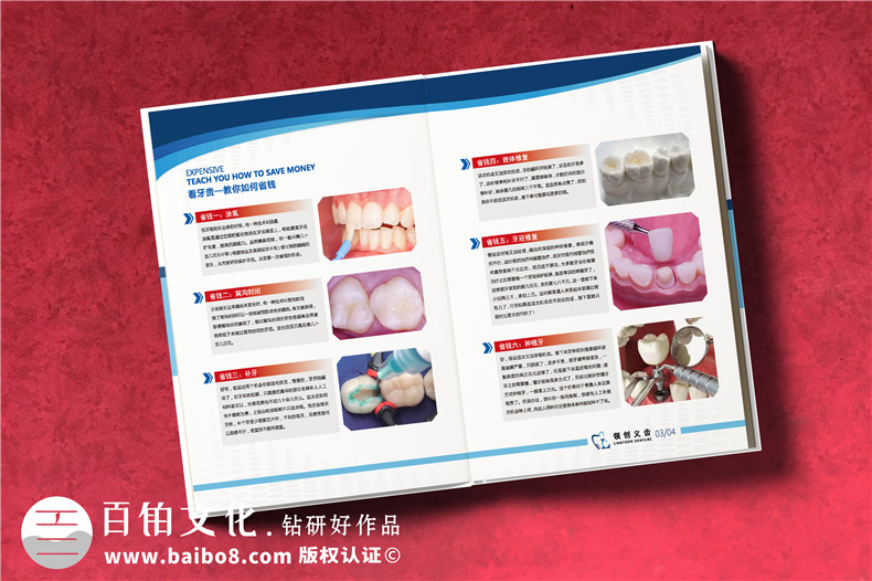 義齒畫冊怎么做-精裝高檔的義齒制作公司產品宣傳冊