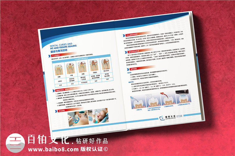 義齒畫冊怎么做-精裝高檔的義齒制作公司產品宣傳冊