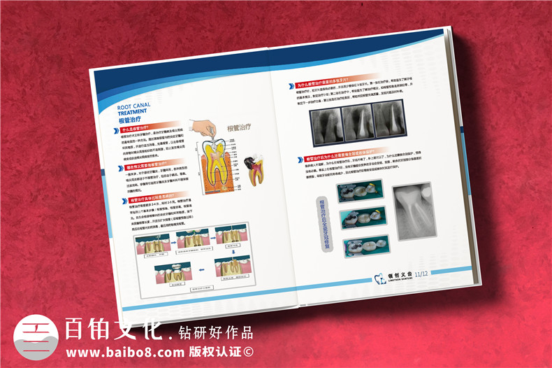 成都義齒產(chǎn)品宣傳畫冊設(shè)計(jì)-牙科技術(shù)開發(fā)產(chǎn)品冊